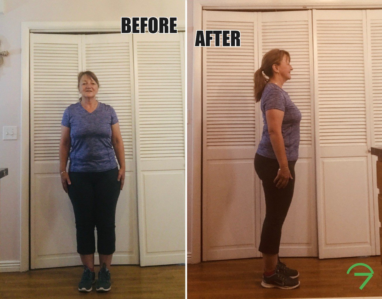 client_karen_before_after_combined Home